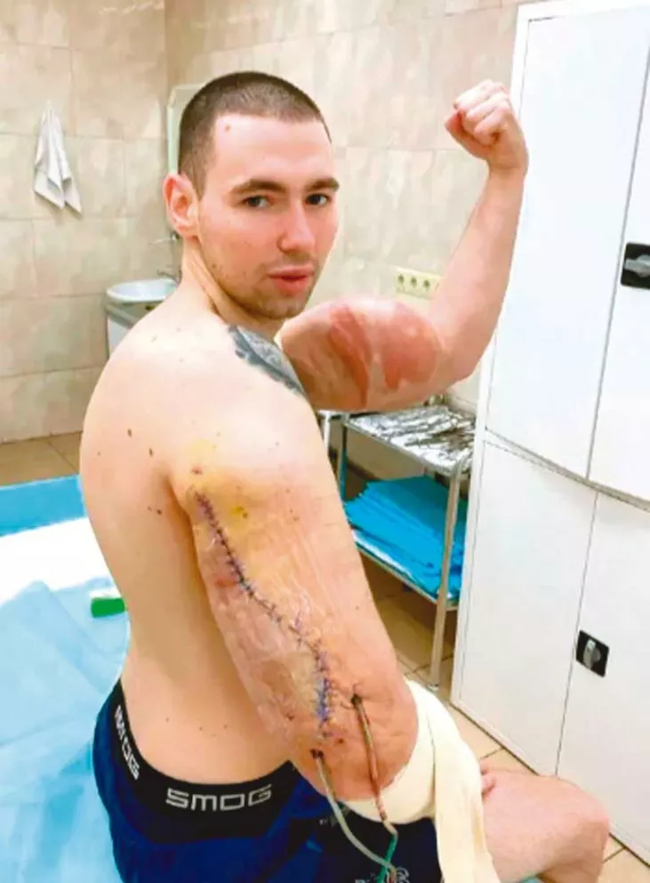Al ‘Popeye ruso’ se le estalló un brazo durante una pelea