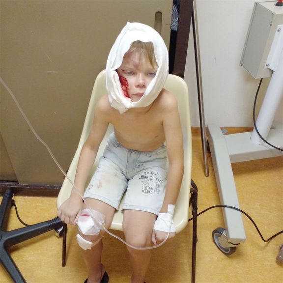 Rottweiler atacó y desfiguró  a un niño de 7 años en Oberá