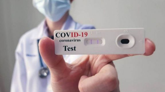 Covid-19: los primeros autotest estarían disponibles desde la próxima semana en farmacias, a 1.560 pesos