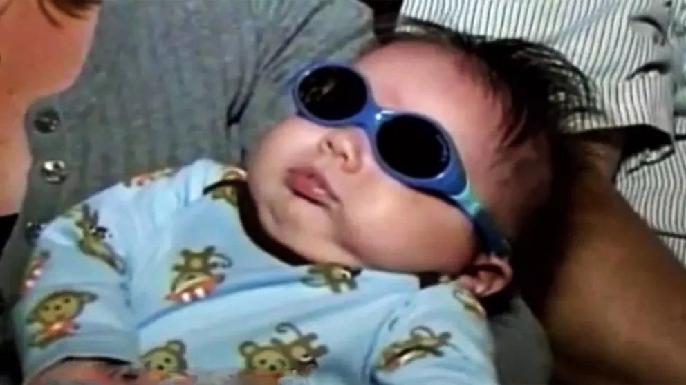 Un bebé nació sin ojos