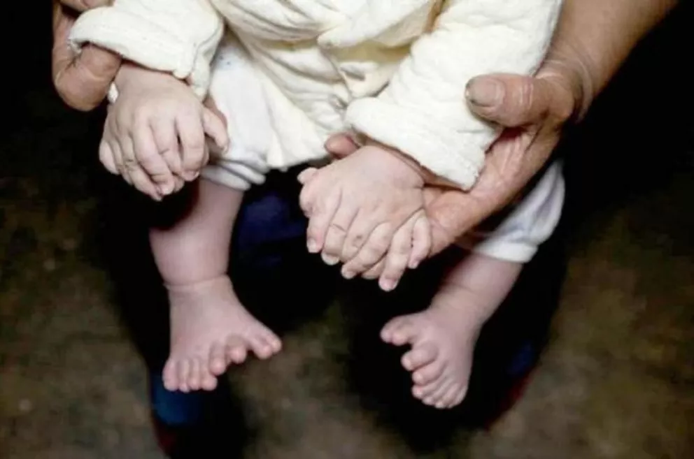Bebé chino nace con 16 dedos en las manos y 15 en los pies 
