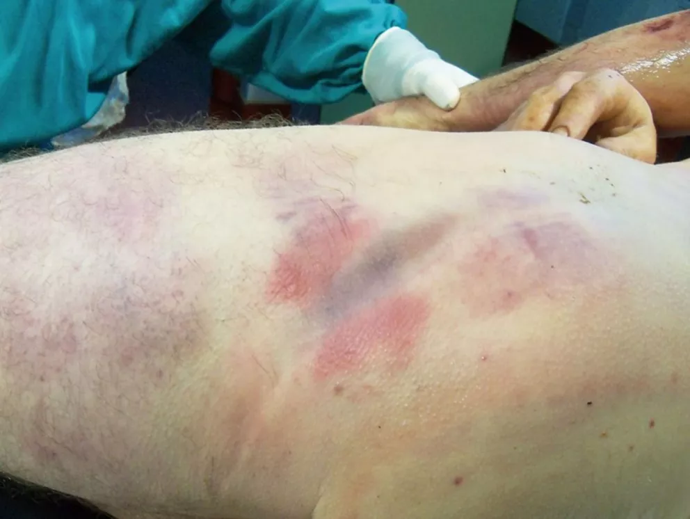 Imágenes exclusivas que confirman la brutalidad policial contra Wasyluk 