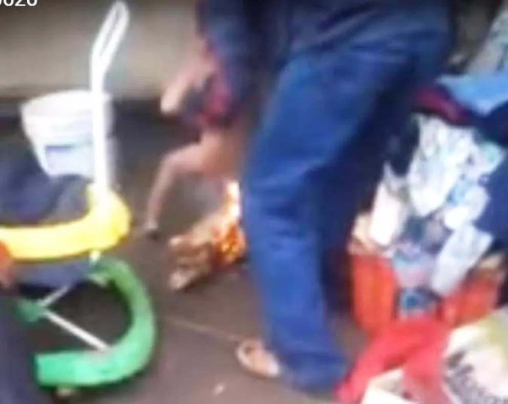 Paraguay: joven quemó a su hijastro de tres años y quedó detenido 