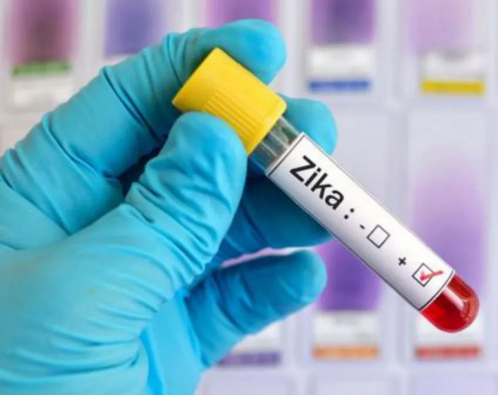Científicos hallaron anticuerpos capaces de detener los virus del zika y dengue