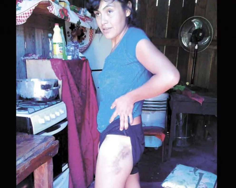 Pequeño héroe de 7 años defendió a su mamá de los golpes del concubino