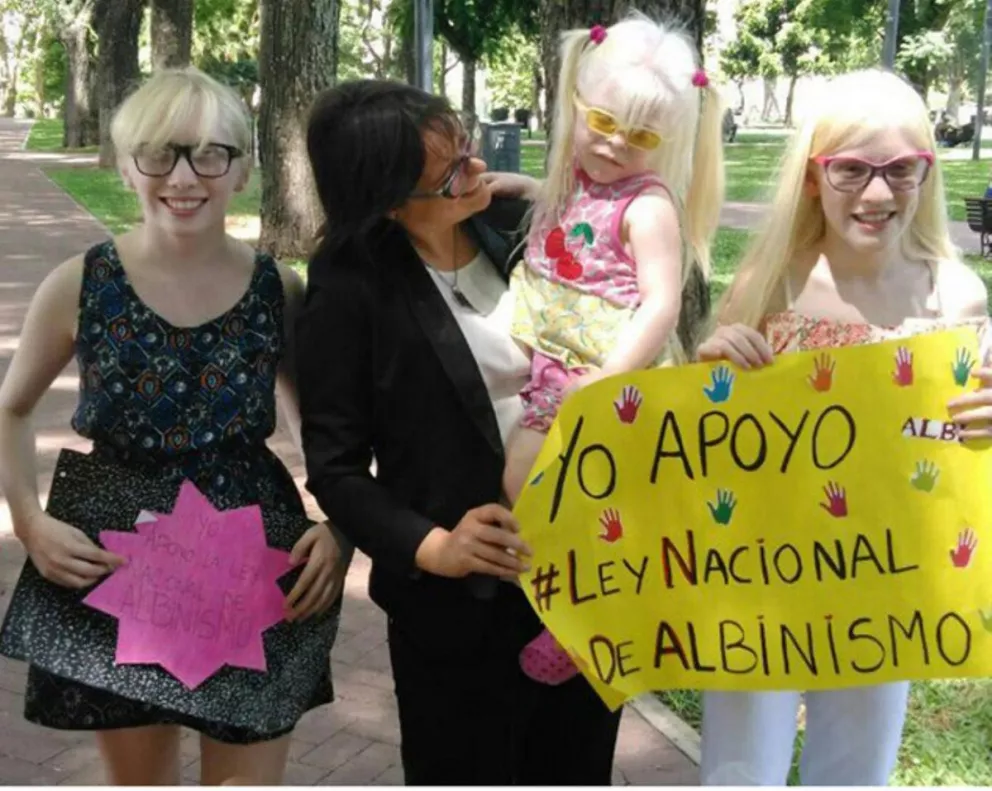 El albinismo en Argentina