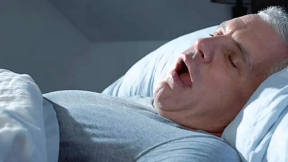 La apnea del sueño aumenta las probabilidades de fibrilación auricular
