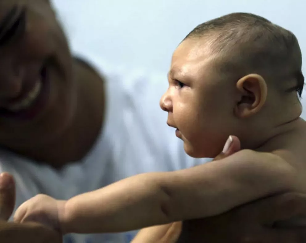 Vacunas experimentales podrían proteger al feto del Zika