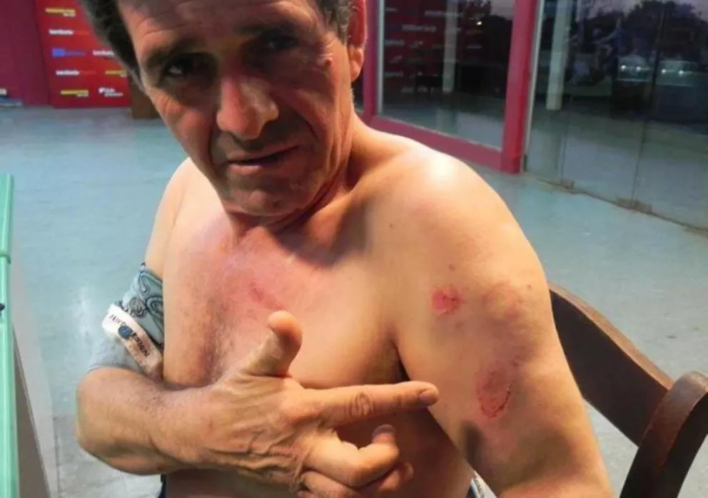Taxista posadeño terminó herido tras ataque en disputa por clientes 
