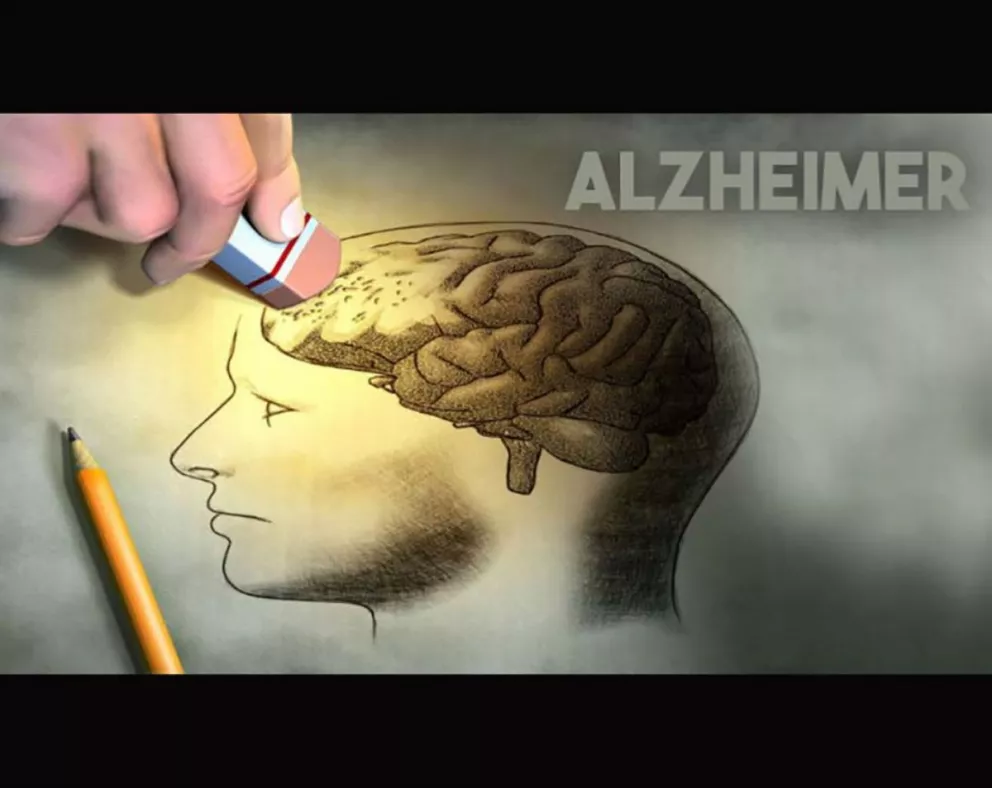 En Posadas se realizarán actividades por el Día Mundial del Alzheimer