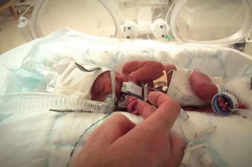 Súper bebé: vino al mundo con 27 semanas y 745 gramos y ha logrado sobrevivir