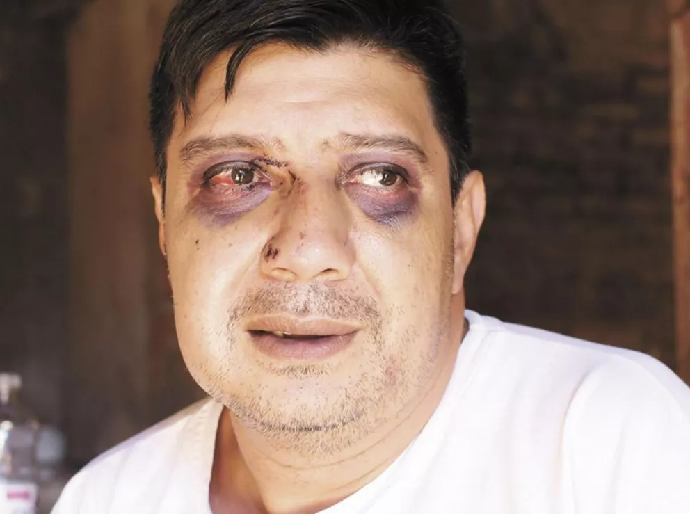 Le desfiguraron la cara de un piedrazo tras un ataque piraña en Villa Cabello