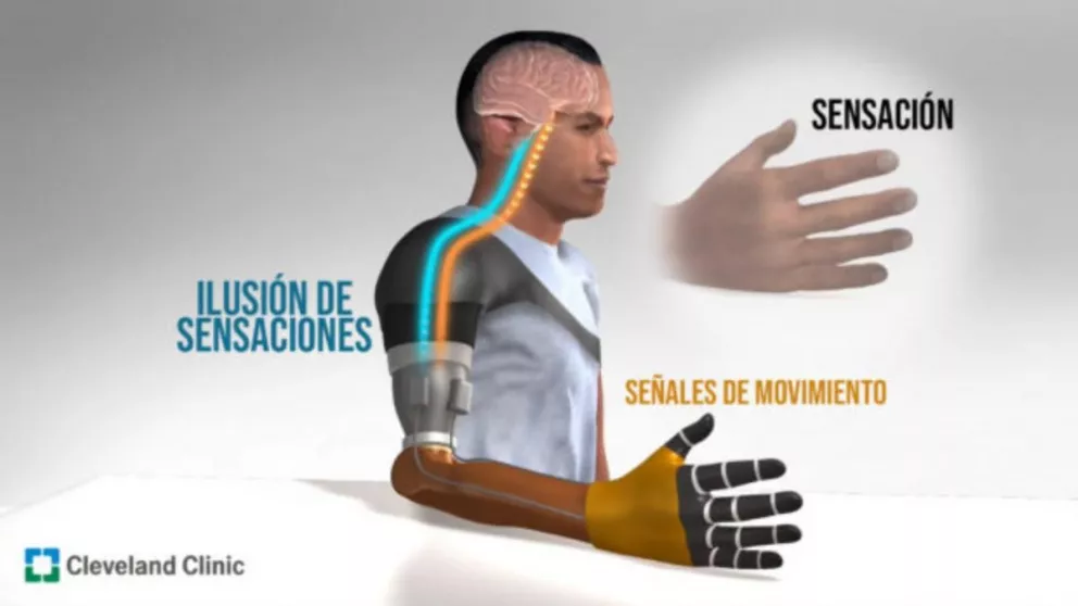 Logran que pacientes con prótesis puedan sentir los movimientos 