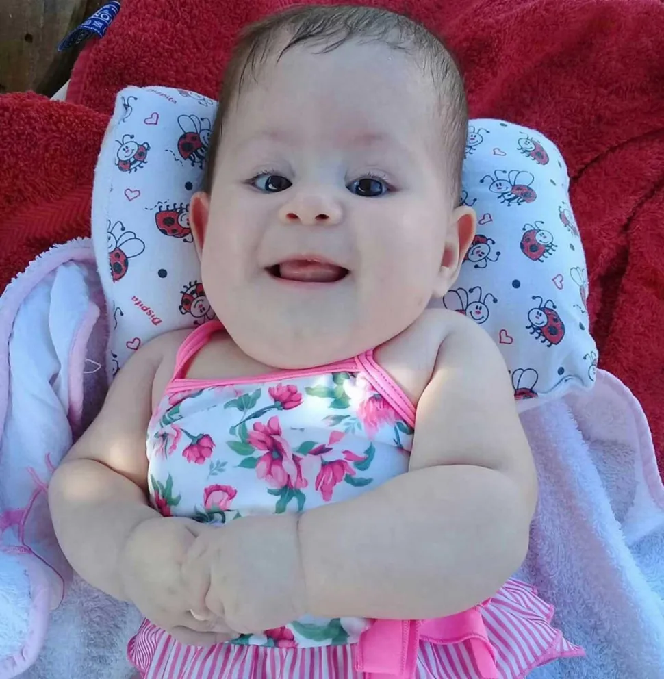 La niña padece hidrocefalia.
