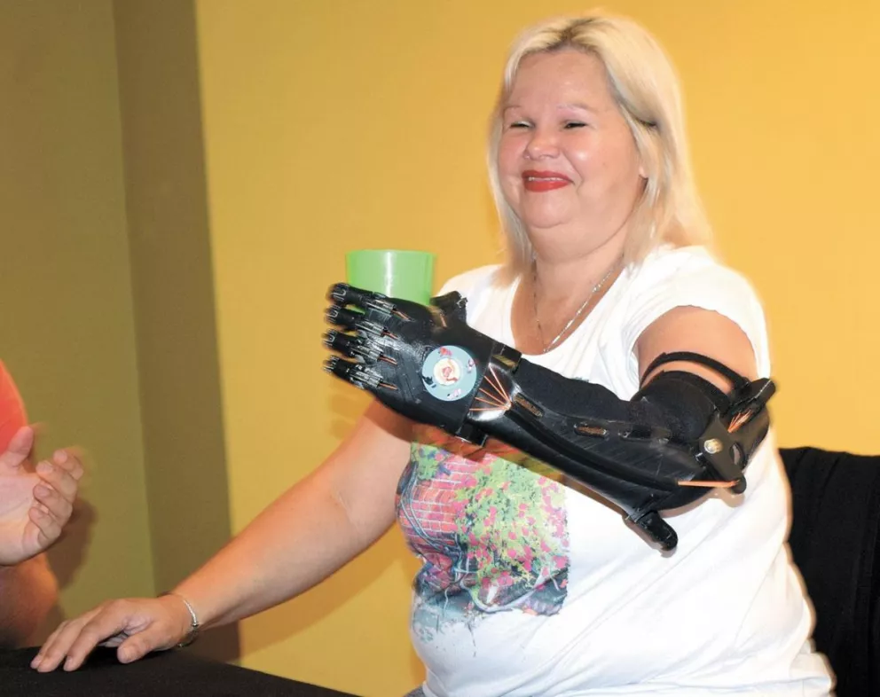 Sonia recibió su prótesis por la que esperó durante 16 años.