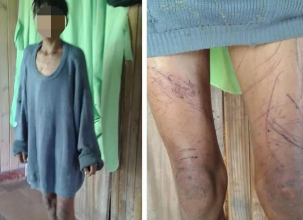 Hallaron herido y desorientado a un adolescente en zona rural de El Soberbio 