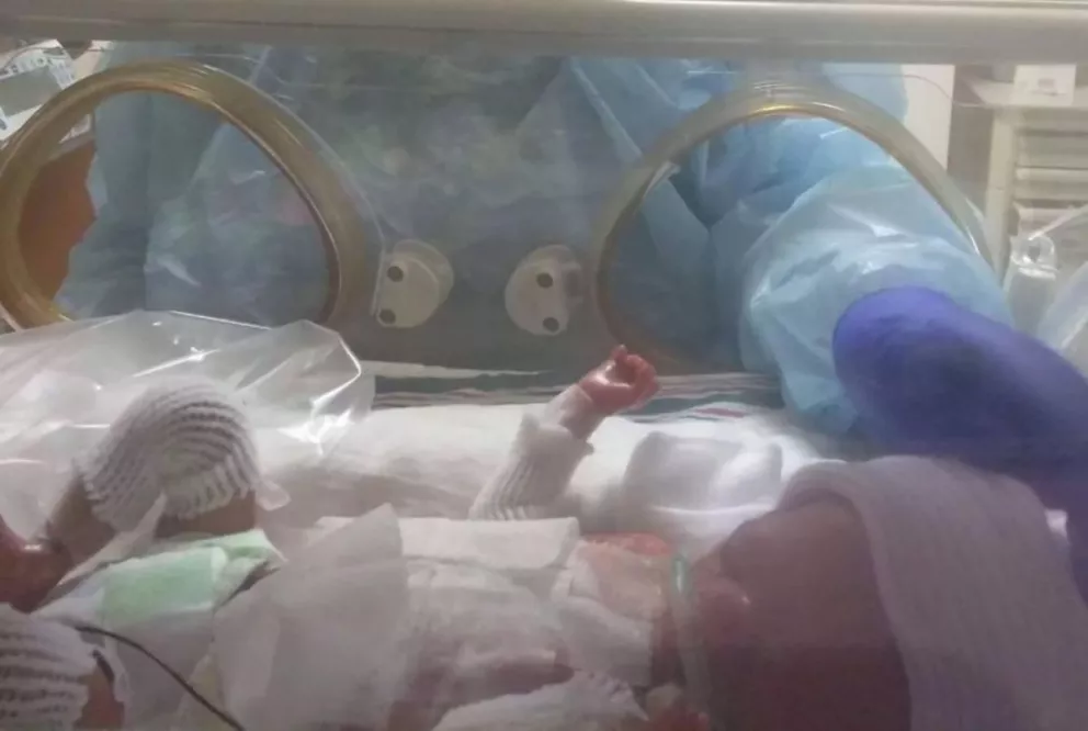 El extraño caso del bebé que nació sin piel y que aún no tiene diagnóstico