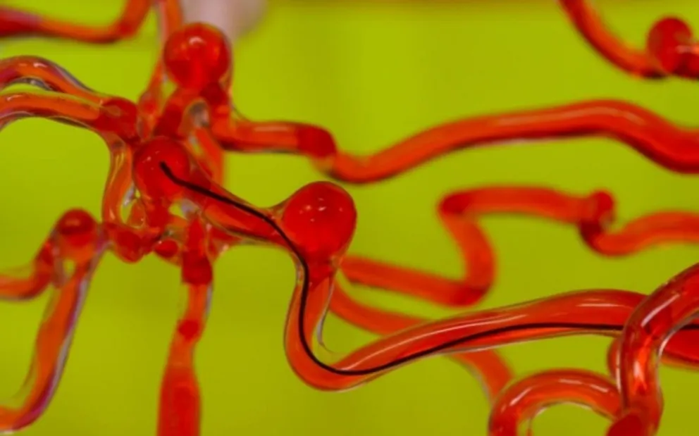 El robot con forma de hilo que puede deslizarse a través del cerebro para salvar vidas