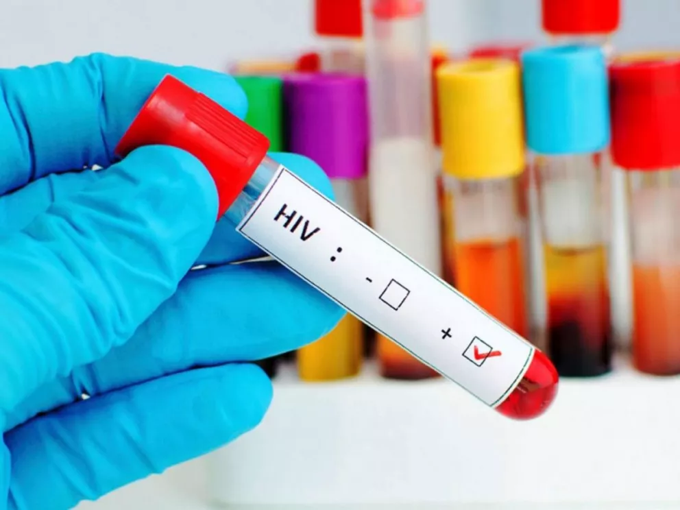Un nuevo recorte en el área de salud genera preocupación en pacientes con VIH