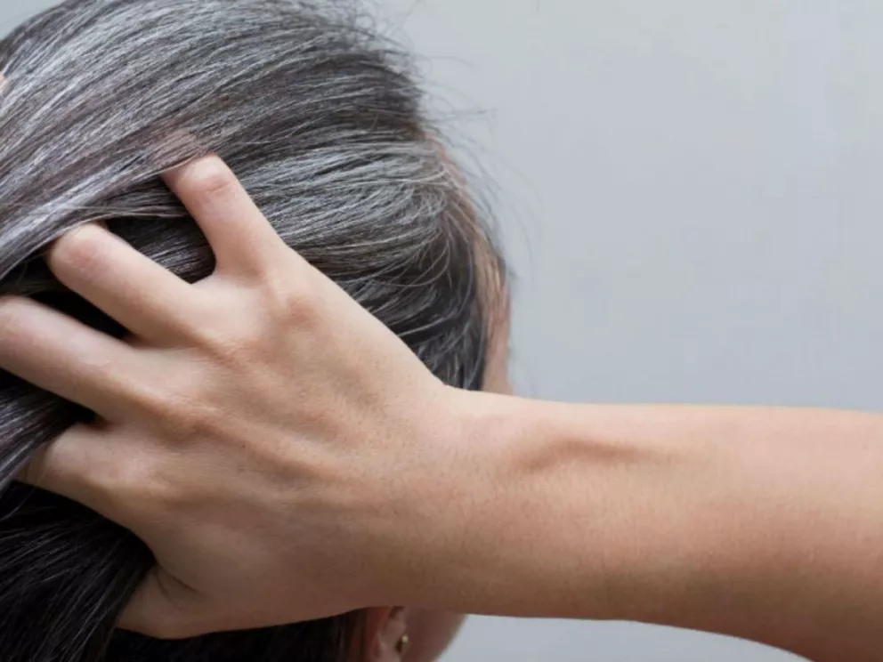 La ciencia resuelve la gran pregunta: cómo el estrés vuelve el cabello gris