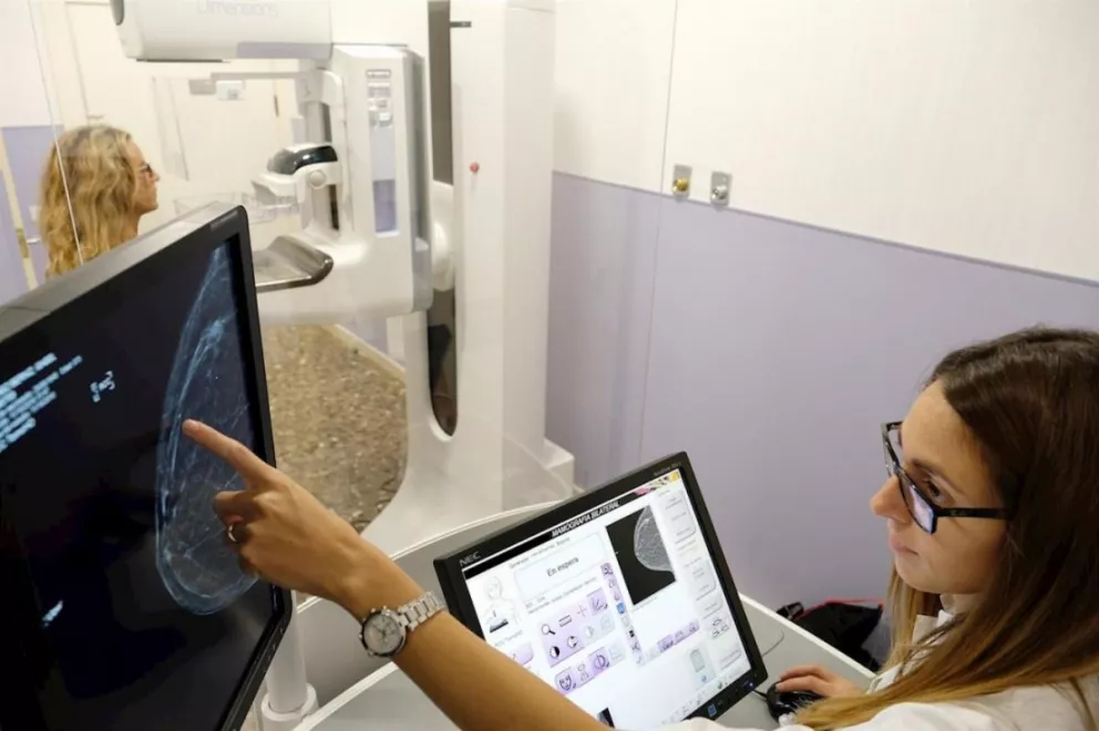 Una nueva IA de Google puede revelar cáncer de mama que los expertos no detectan