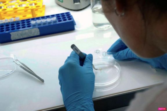 Unas 173.000 personas se encuentran con el virus del Covid-19 activo en Argentina Unas 173.000 personas se encuentran con el virus del Covid-19 activo en Argentina