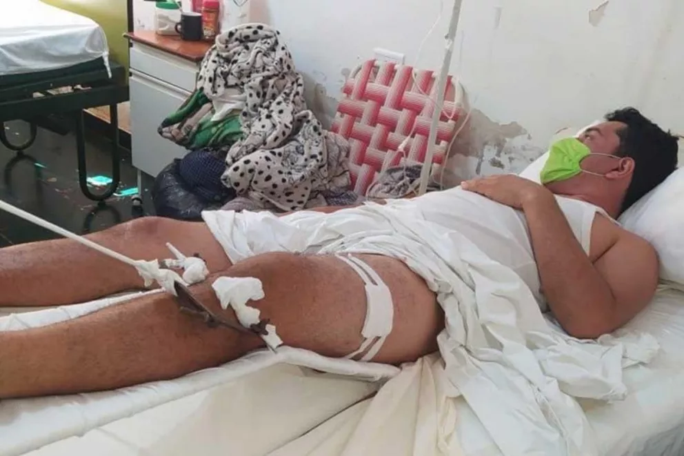 Fabián C. (31) permanece internado en el Samic de Iguazú, a la espera de una intervención quirúrgica.