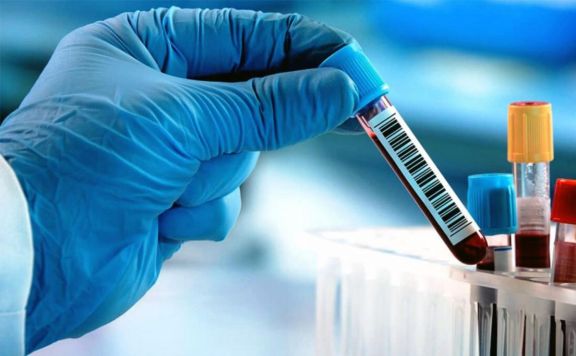 Corrientes reportó 28 nuevos casos de coronavirus Corrientes reportó 28 nuevos casos de coronavirus