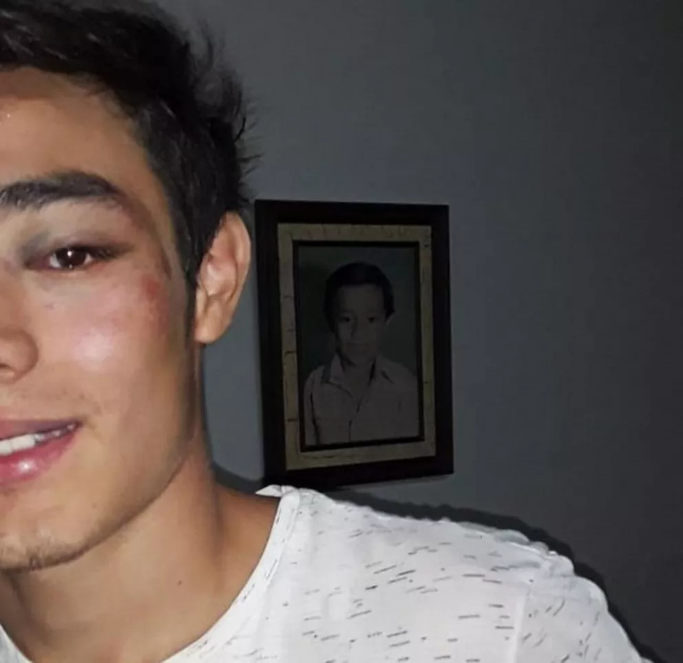 Guillermo Agustín (17), lesionado.