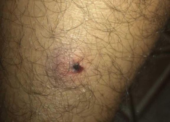 Pablo resultó con heridas en la pierna. Pablo resultó con heridas en la pierna.