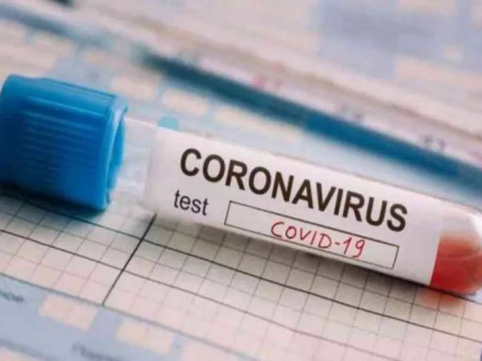 Más de 35.000 muertos desde el inicio de la pandemia de coronavirus en Argentina