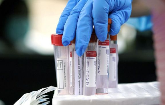 Corrientes reportó más de 200 casos de Covid-19 por segundo día consecutivo Corrientes reportó más de 200 casos de Covid-19 por segundo día consecutivo