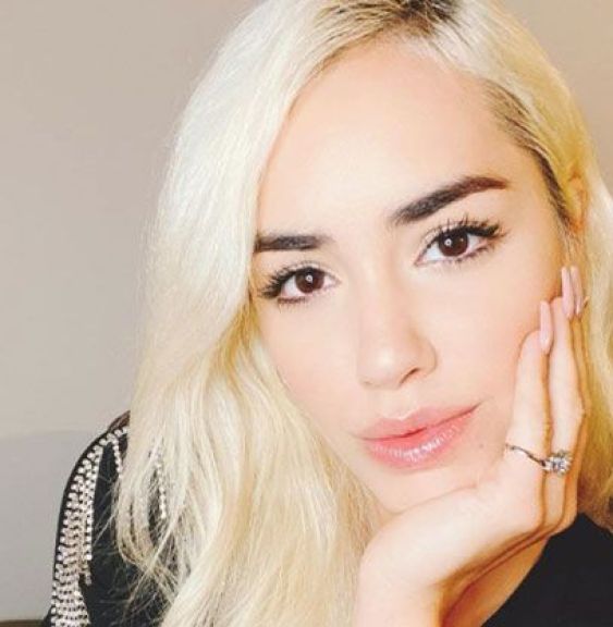 “¡Divino!”: Lali sobre el beso con una modelo venezolana “¡Divino!”: Lali sobre el beso con una modelo venezolana