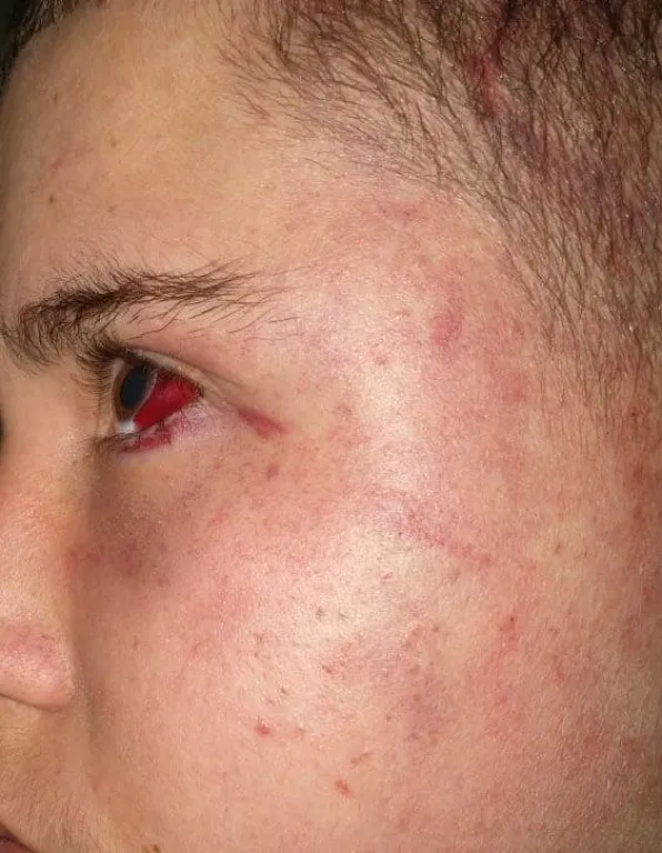 Tiene 15 años y denunció que policías le colocaron una bolsa en la cabeza