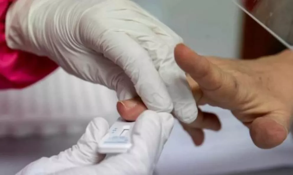 La ANMAT aprobó el test argentino que detecta coronavirus en menos de cinco minutos