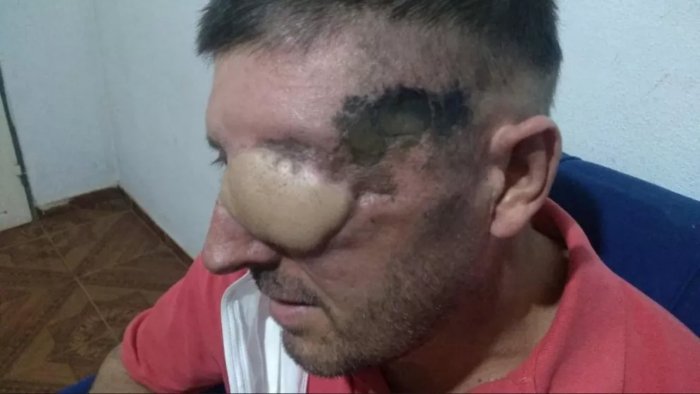 Paciente con discapacidad visual denunció brutalidad policial