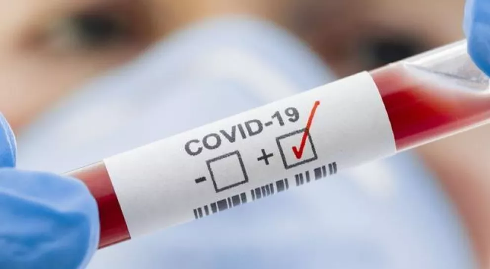 Prueban droga que reduce un 99% carga viral del Covid-19